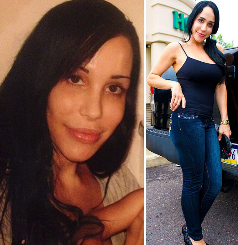 Octomom - ​Nadya Suleman