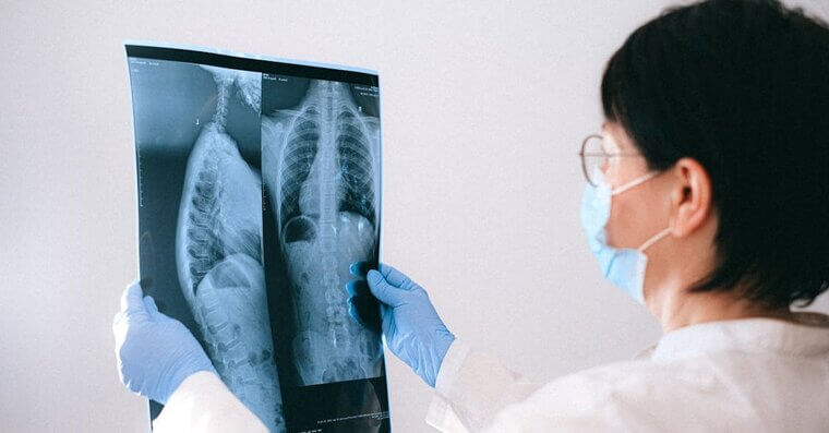 X-Rays for Everything