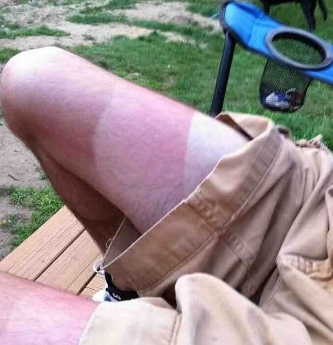 Someone Pass the Aloe Vera