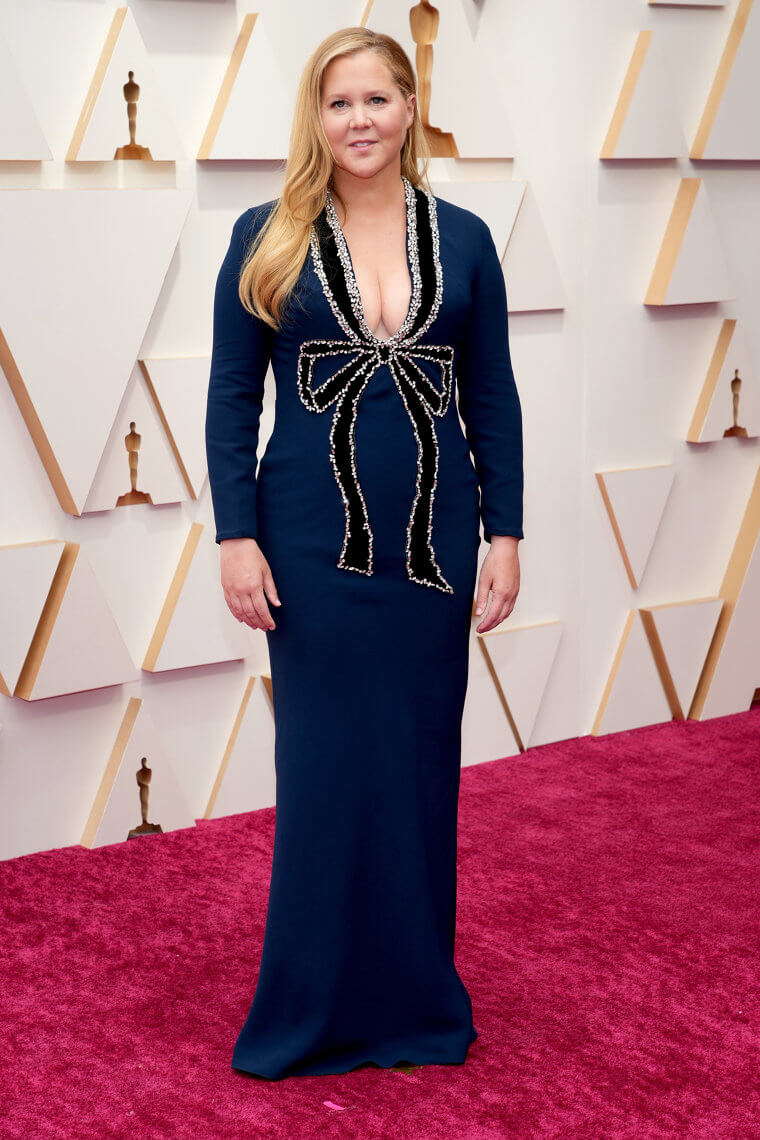 That Time Amy Schumer Looked Like a Walking Gift