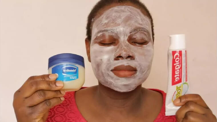 Toothpaste Can Be Used to Treat Acne