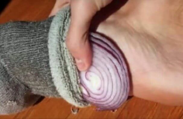 Onion in Your Socks When You Have a Cold