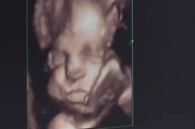 Something Is Wrong With Baby B