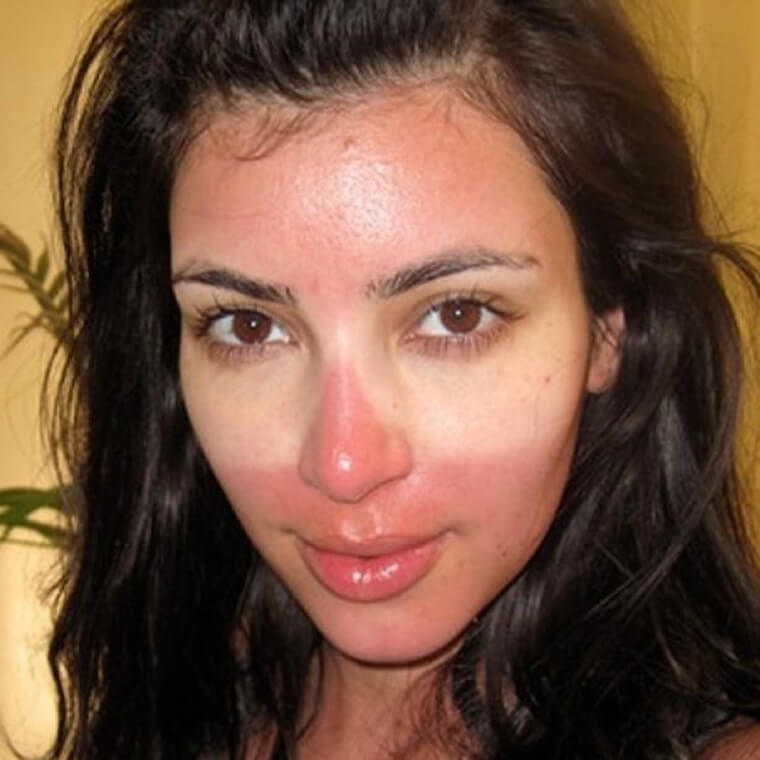 Neuer und fortschrittlicher Sonnenschutz