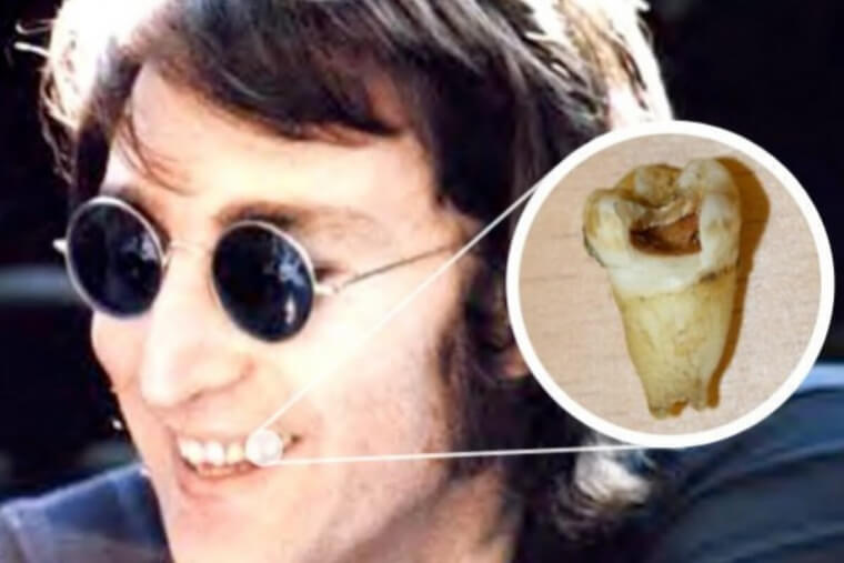 Someone Bought One Of John Lennon's Teeth