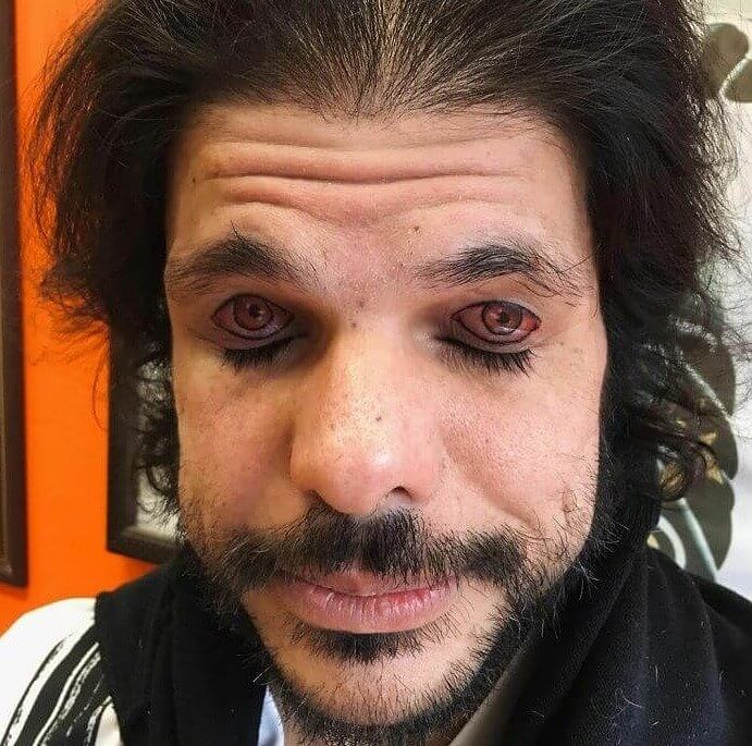 This Guy Just Really Loves Eyes
