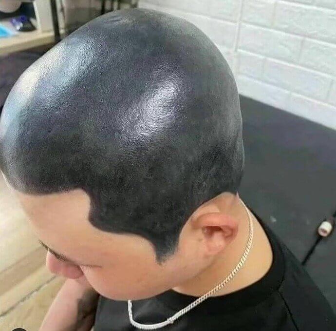 Cheaper Than a Hair Transplant