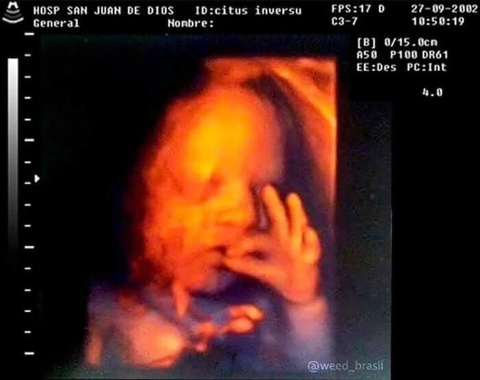 Is It Snoop Dogg's Son?