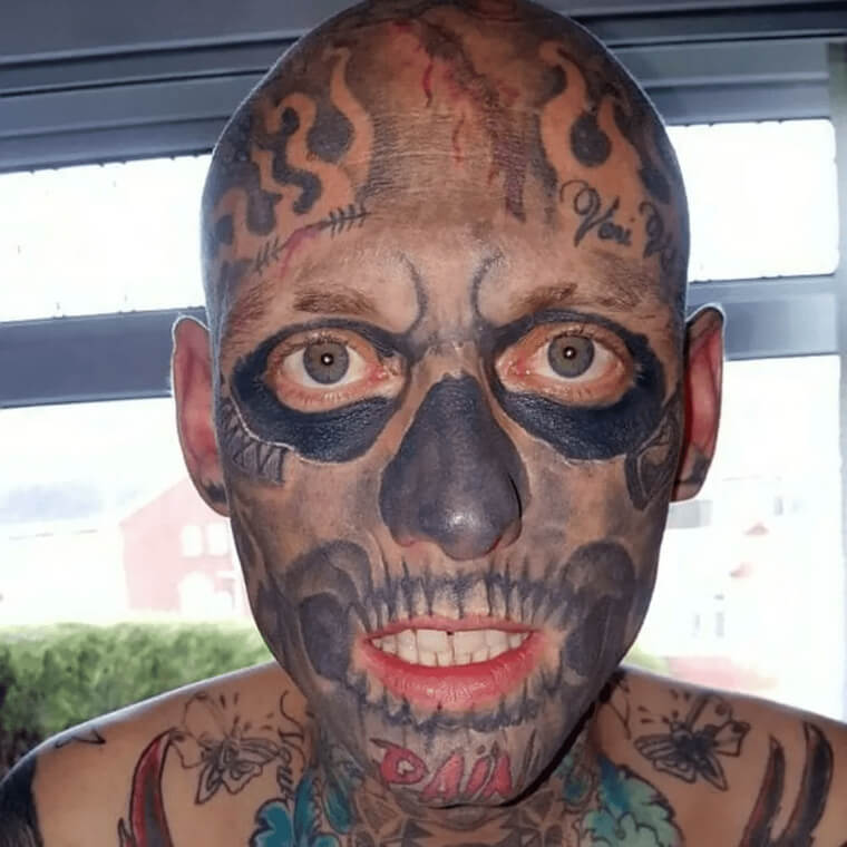 The Skeleton Man