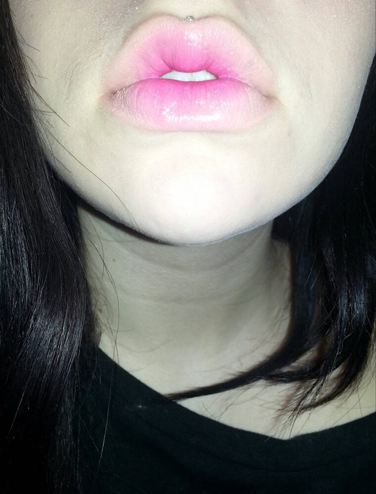 Die Form und Fülle der Lippen wird vom Vater vererbt