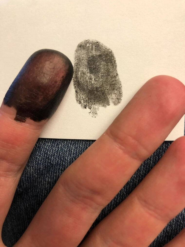 Fingerabdrücke werden von der Mutter vererbt