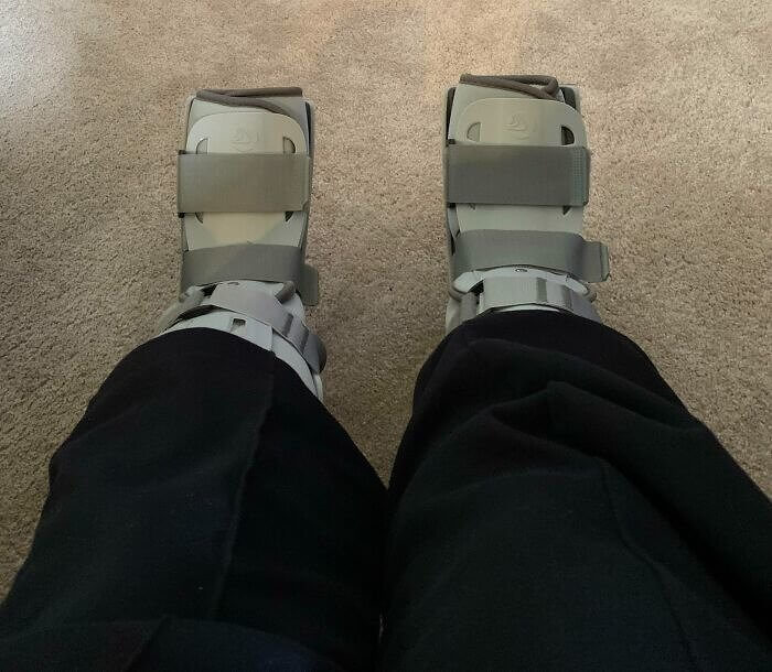 When You Break Both of Your Feet