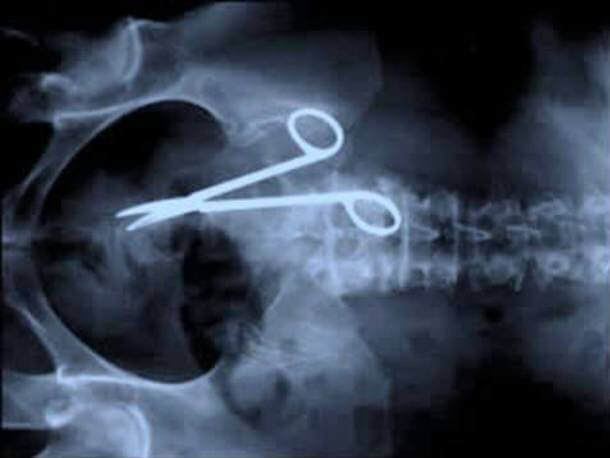Las Radiografías Después De Las Cirugías Son Necesarias Para Ver Que Nada Se Haya Pasado Por Alto